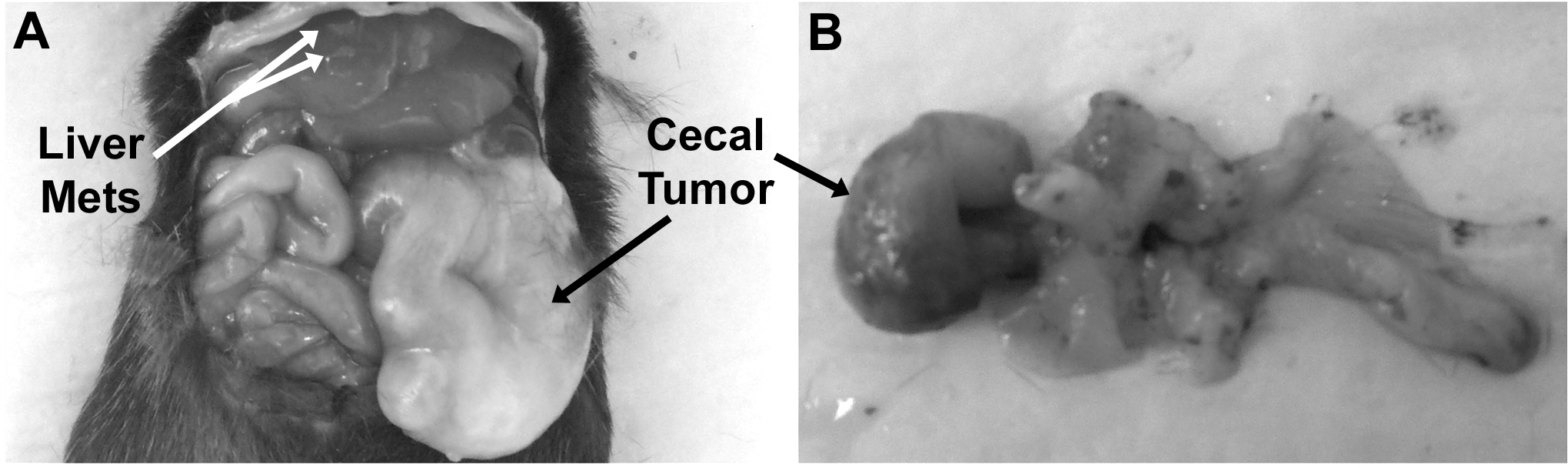 What is a cecal mass?